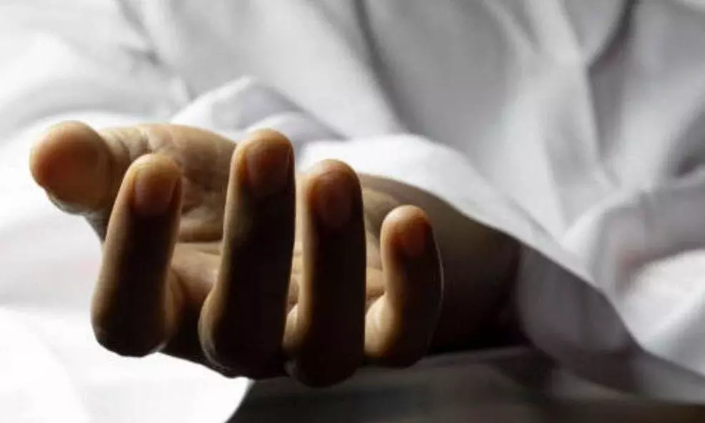 Senior Official Succumbs to Burns Senior Official Succumbs to Burns