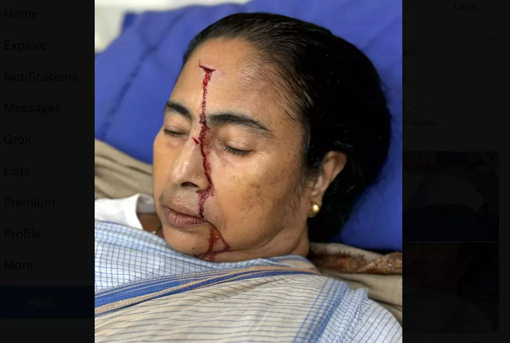 Mamata Suffered Cerebral Concussion Due to Push From Behind: Docs