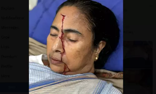 TMC: Didi Fell Down Accidentally; Doctor Claims Push from Behind Logic Misinterpreted TMC: Didi Fell Down Accidentally; Doctor Claims Push from Behind Logic Misinterpreted