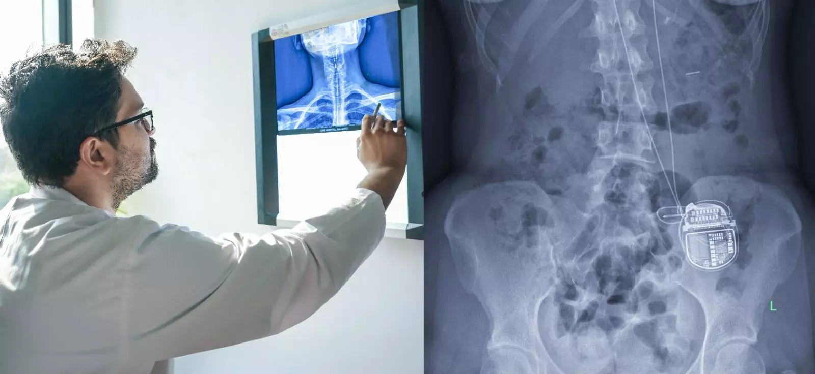 AIG Uses Implant To Cure Chronic Headaches AIG Uses Implant To Cure Chronic Headaches