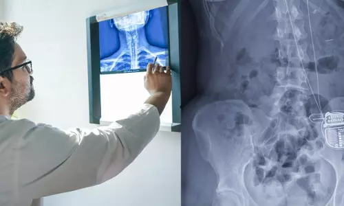 AIG Uses Implant To Cure Chronic Headaches