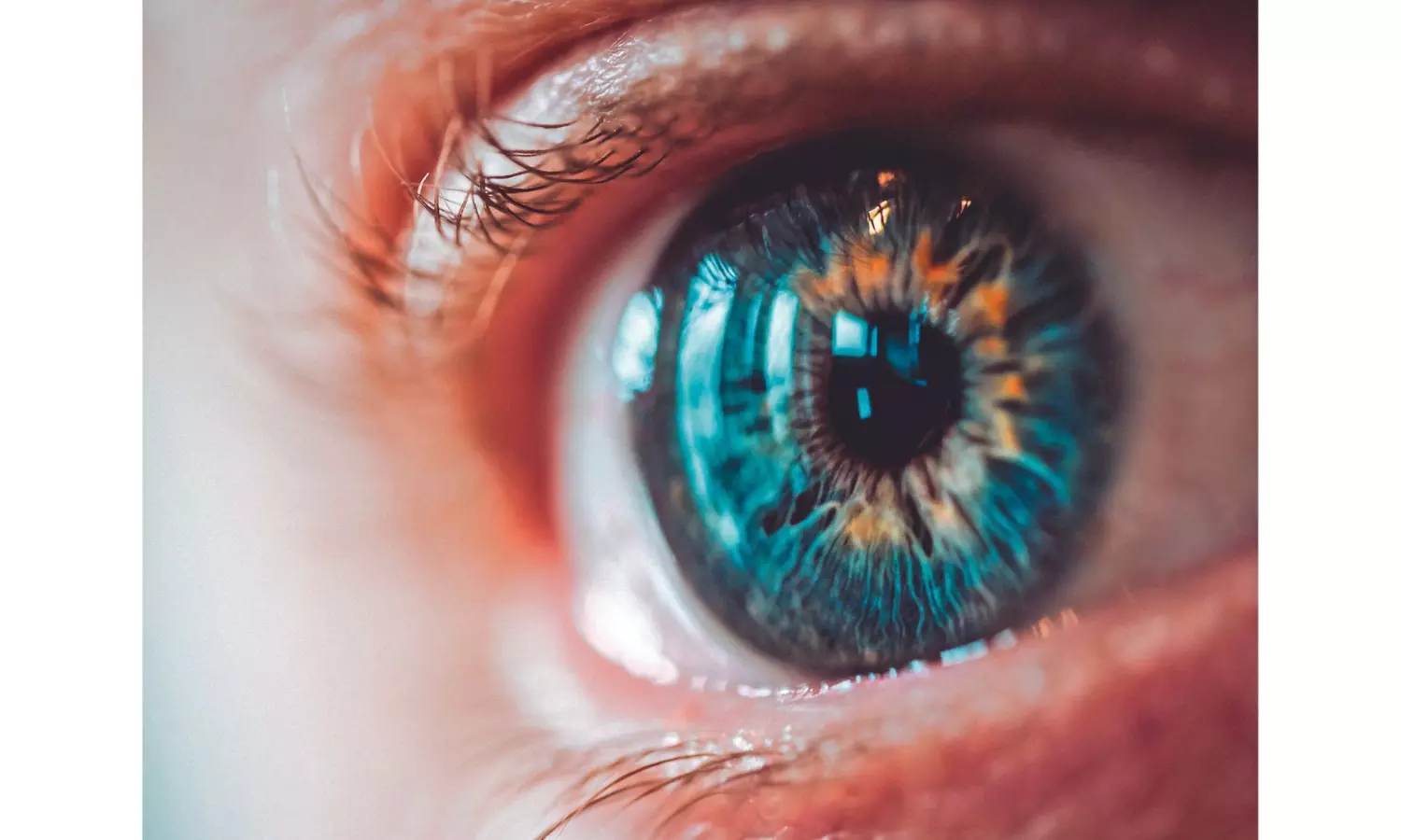 Living with dry eye Living with dry eye