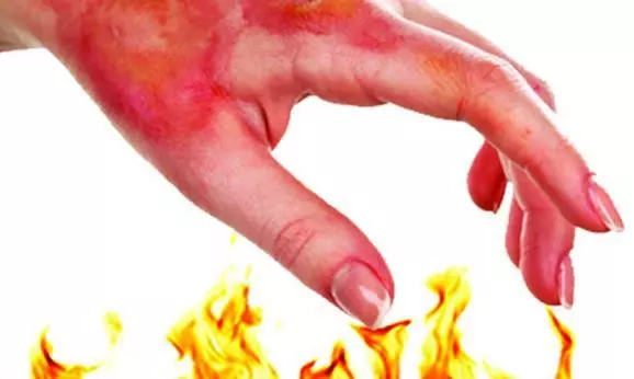 Hot Water Singes Student in Icfai Hostel