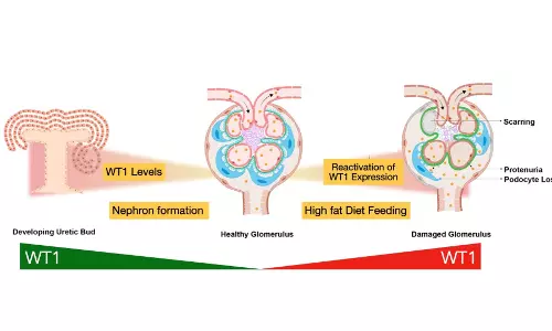 Hyderabad Researchers Uncover Link Between Obesity and Kidney Disease