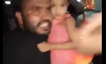 Bike rider injured  after being hit by rash car driver