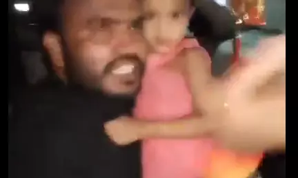 Bike rider injured after being hit by rash car driver Bike rider injured after being hit by rash car driver