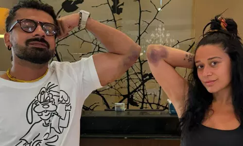 KKK14: Two contestants injured during stunts