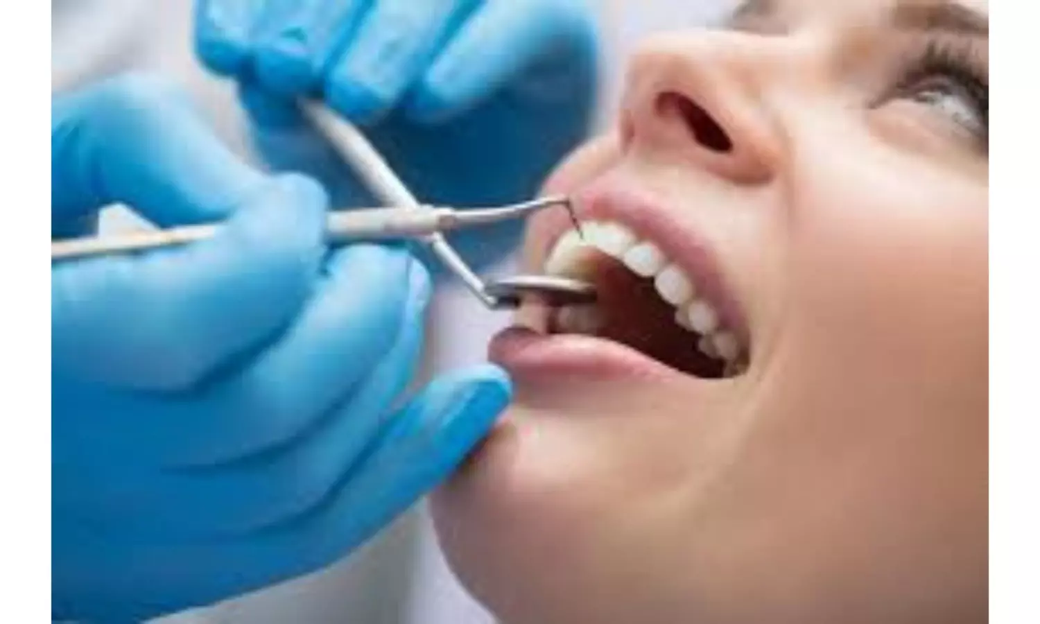 Delay in Telangana dental services counselling costs students seats