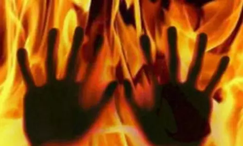 AP: Woman Burns Daughter’s Hands with Iron Rod AP: Woman Burns Daughter’s Hands with Iron Rod