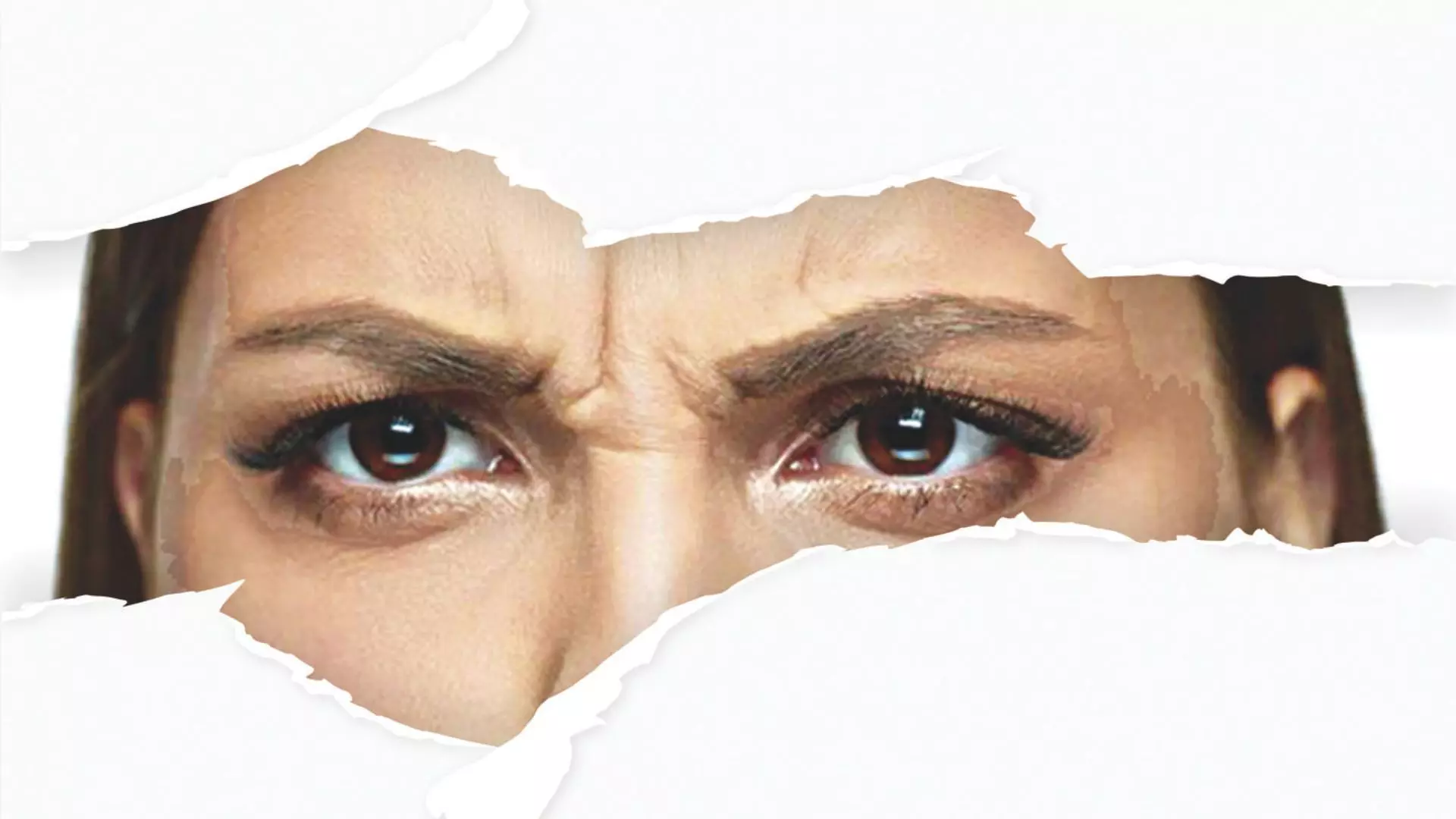 An Eye-opener On Eyebrow Hair Loss An Eye-opener On Eyebrow Hair Loss