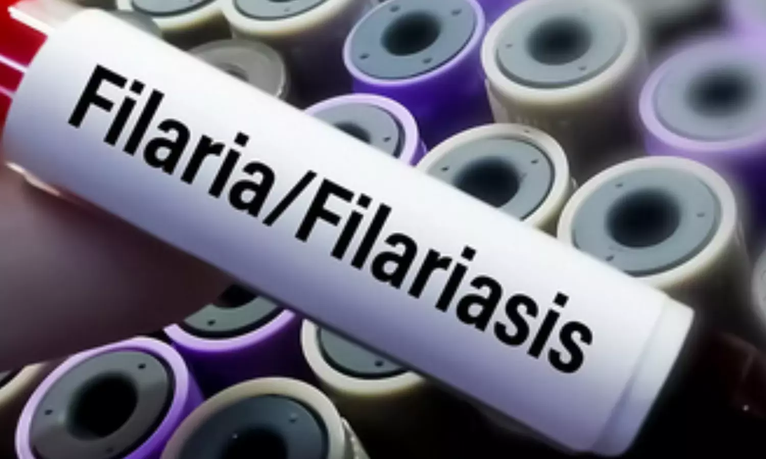 Andhra Pradesh Health Department to Conduct Filaria Survey in Pedapenki