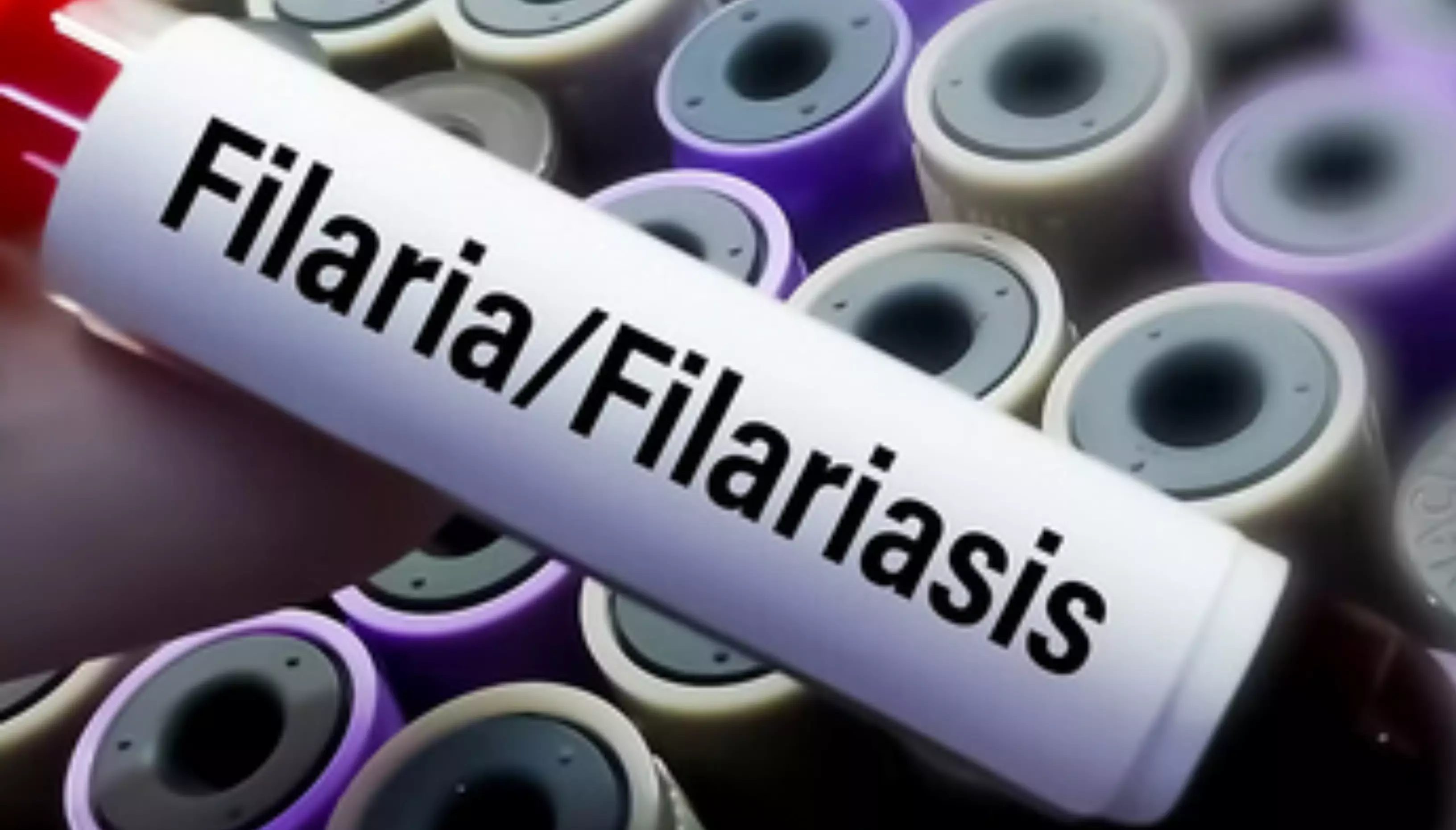 Andhra Pradesh Health Department to Conduct Filaria Survey in Pedapenki Andhra Pradesh Health Department to Conduct Filaria Survey in Pedapenki