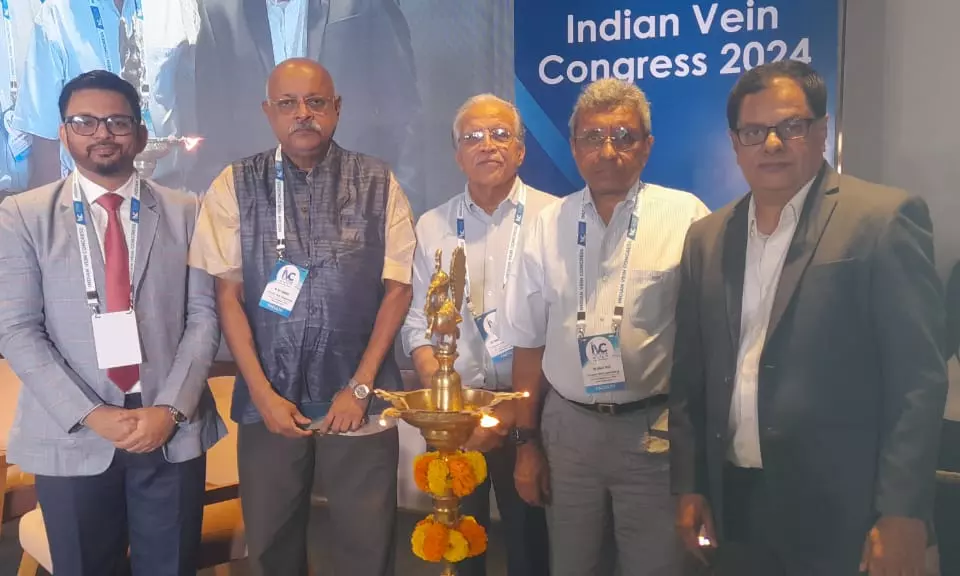 25% of Indians Affected by Varicose Veins