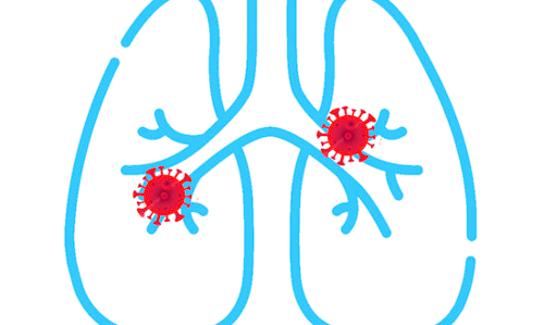 Walk-in Pneumonia Alert!