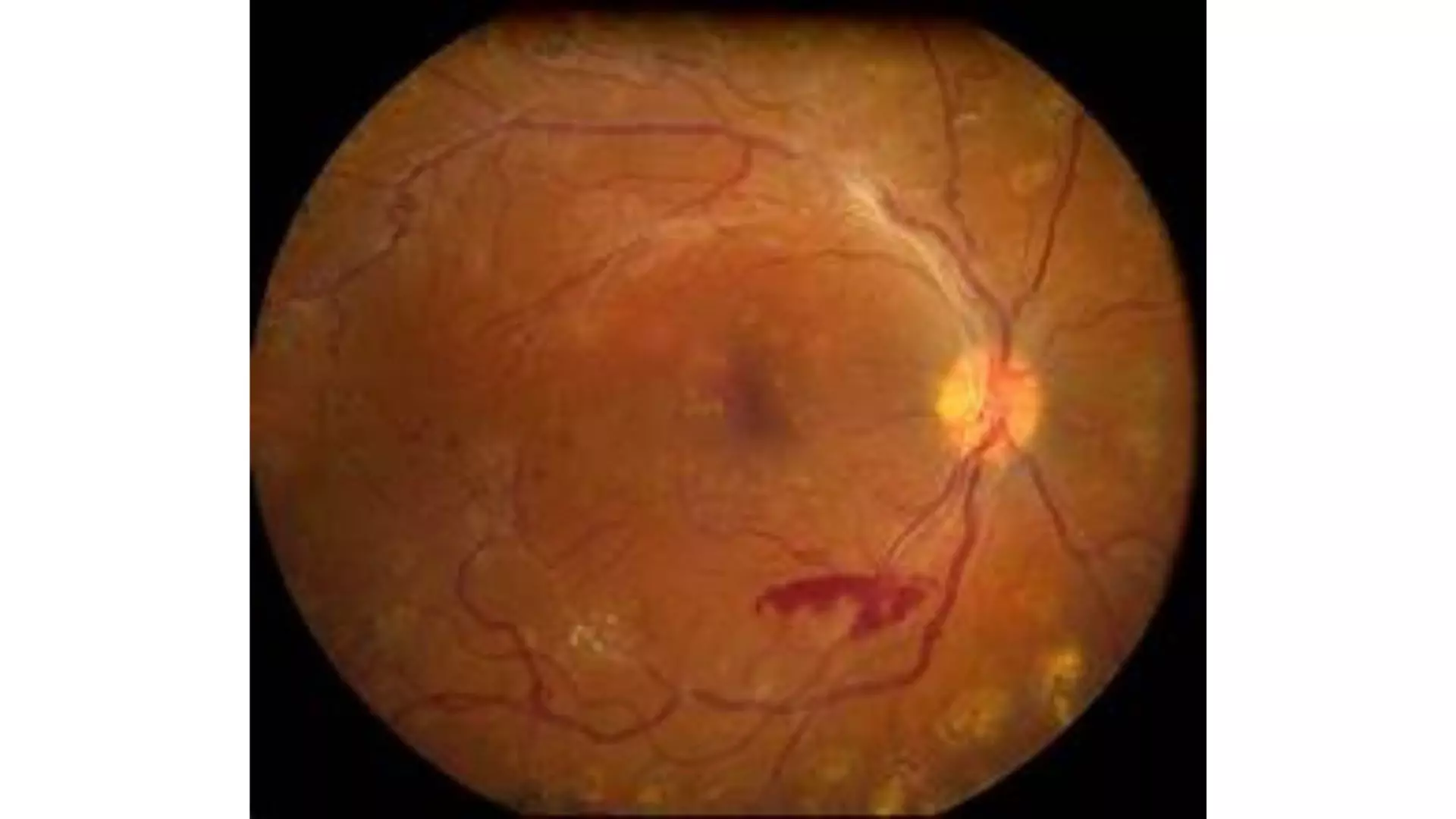 Review meeting addresses congenital eye diseases in children Review meeting addresses congenital eye diseases in children