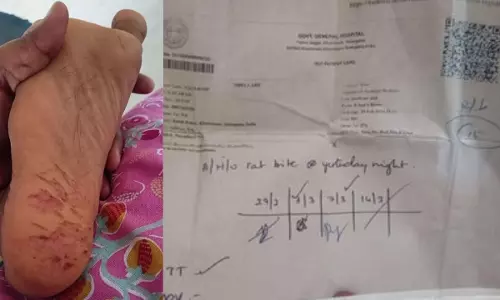 Student paralysed after rat bite still under treatment