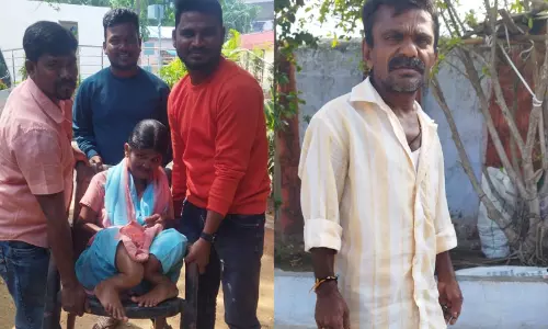 New Dental Fluorosis Cases Emerge in Nalgonda