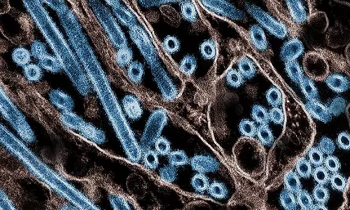 US records its first human death from bird flu