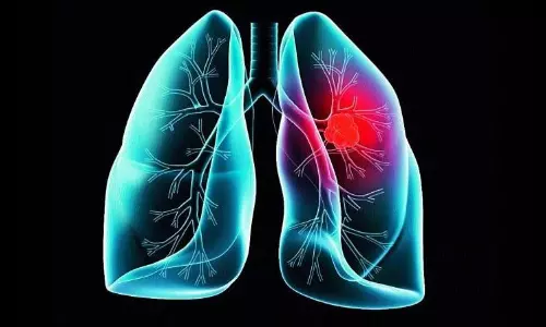 Air Pollution Leading to an Increase in Lung Cancer Cases Among Non-Smokers