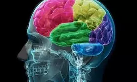 VNS to help drug-resistant epilepsy patients