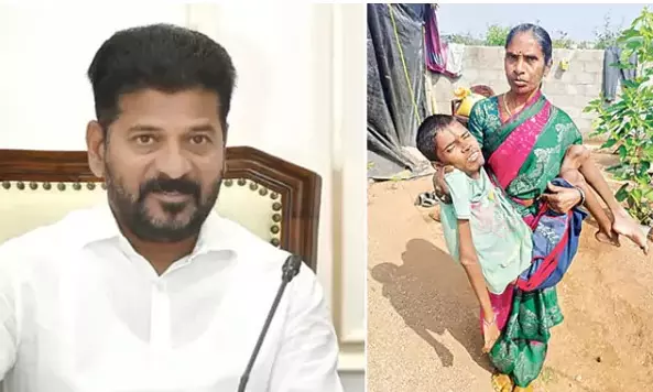 CM Revanth Extends Support to Student with Muscular Dystrophy