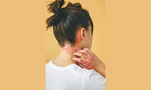 Dietary Triggers And Skin Woes