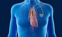 102-year-old woman gets pacemaker in Kolkata 102-year-old woman gets pacemaker in Kolkata
