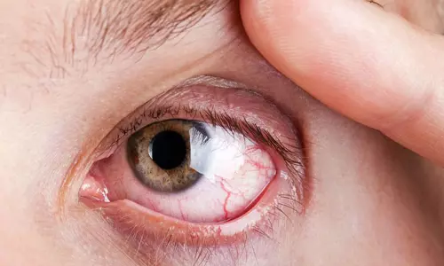 Diabetic Retinopathy: The increasing need for early detection and awareness