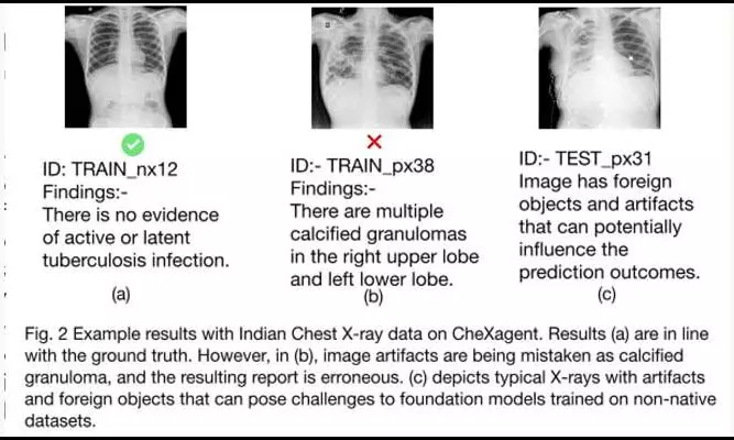 India Needs Medical Datasets To Exploit GenAI in Diagnostics
