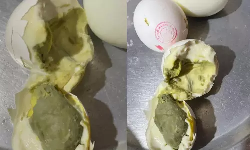 Hyderabad: Rotten Eggs of Anganwadi Sparks Concerns