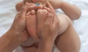Clubfoot Treatment Available At Kurnool GGH Clubfoot Treatment Available At Kurnool GGH
