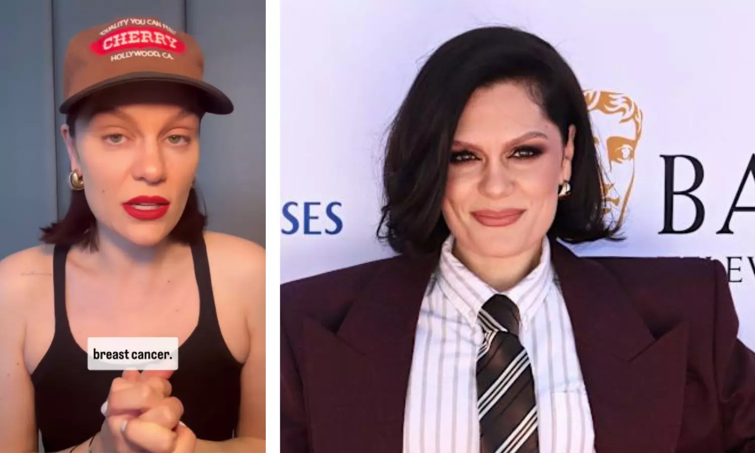 Jessie J Reveals Early Breast Cancer Diagnosis in Emotional Instagram Post