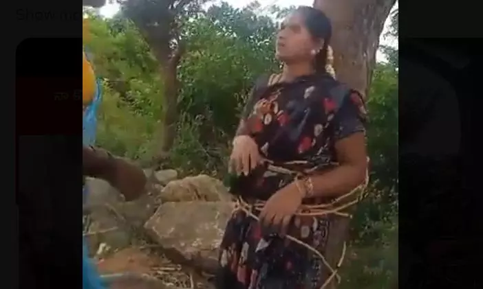 Government Hands Over Rs.5 Lakh to Kuppam Assault Victim