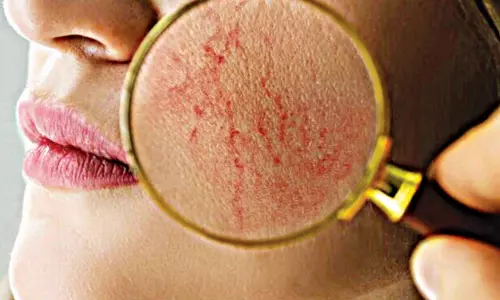 Never Overlook Your Skin’s Heartfelt Signs Never Overlook Your Skin’s Heartfelt Signs