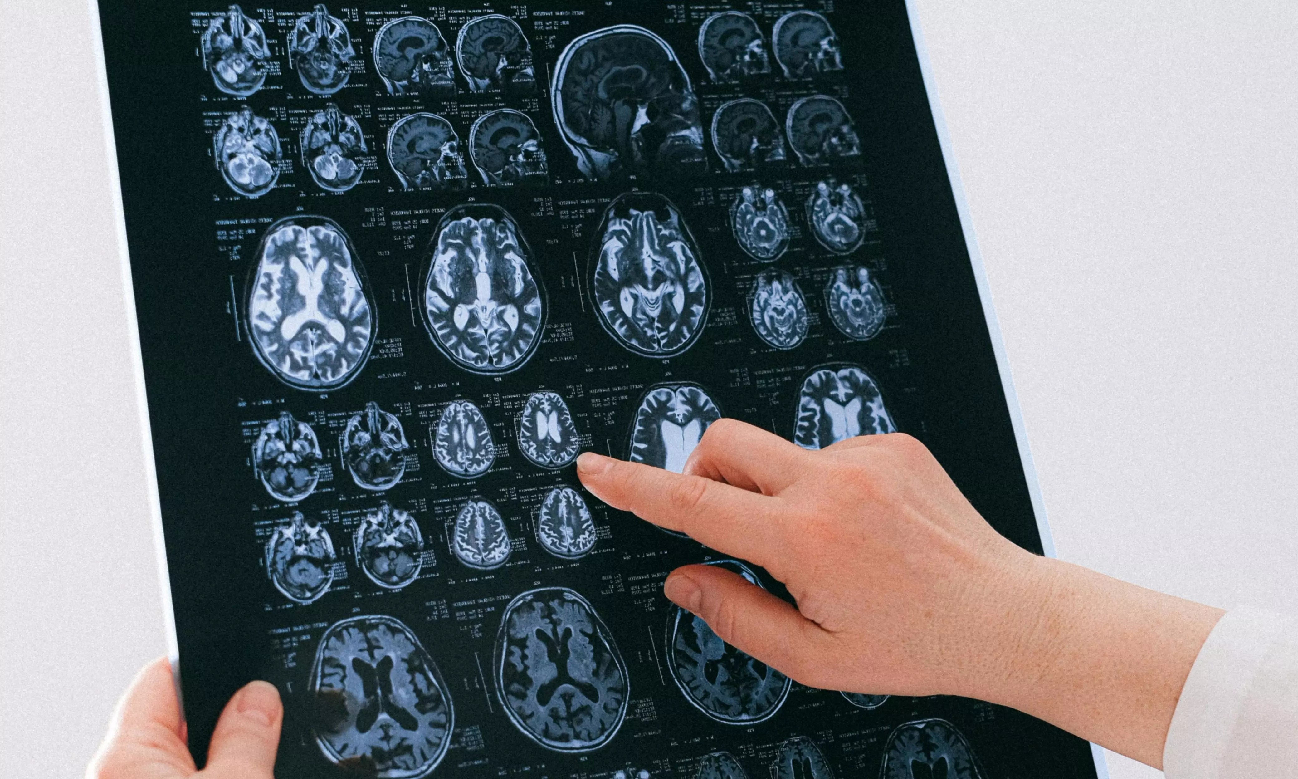 Brain Scans Show How Extreme Conditions Impact Physiology, Cognition