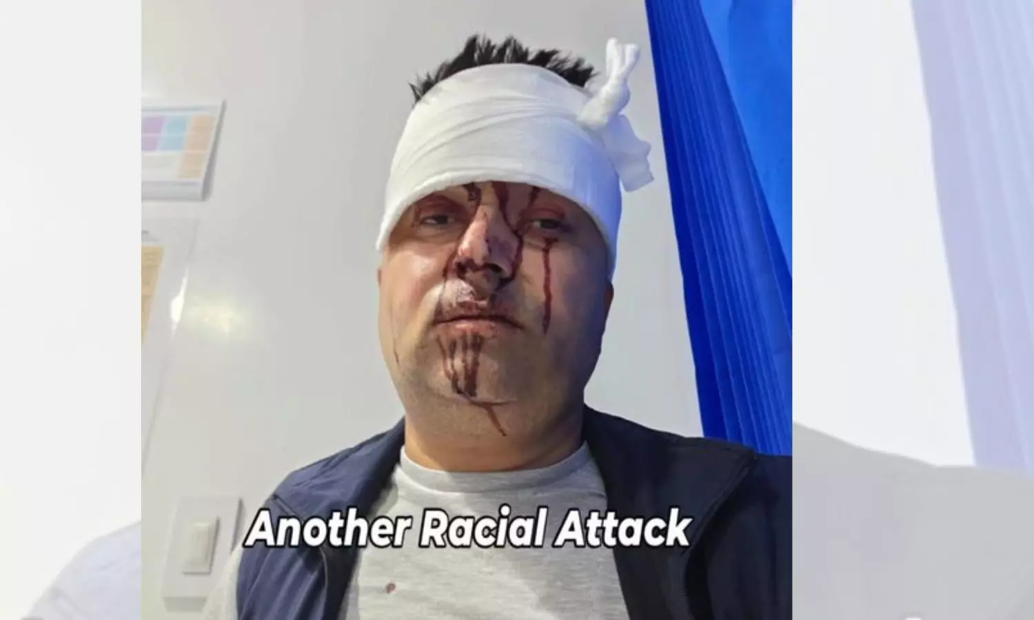 Indian-Origin Taxi Driver Attacked in Dublin Amid Rising Racist Assaults
