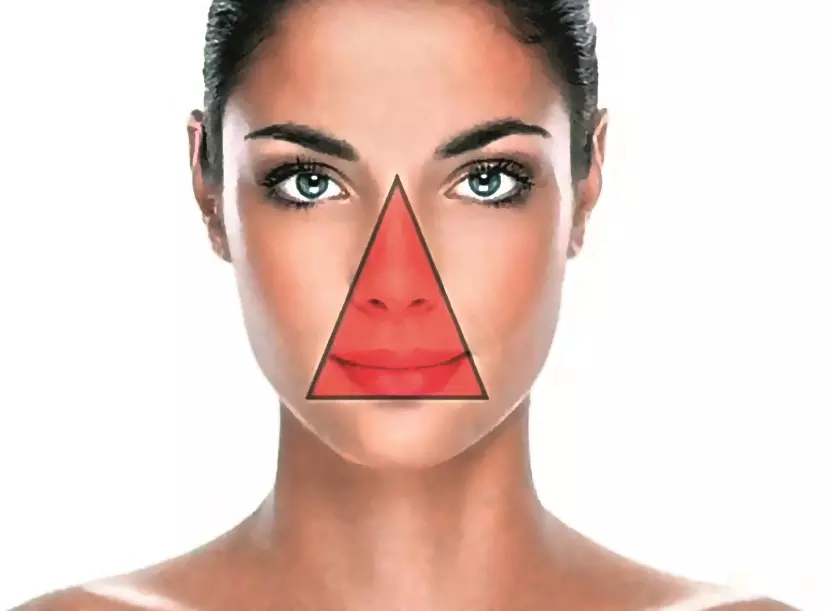 Pimple Poppers in Triangle of Danger Pimple Poppers in Triangle of Danger