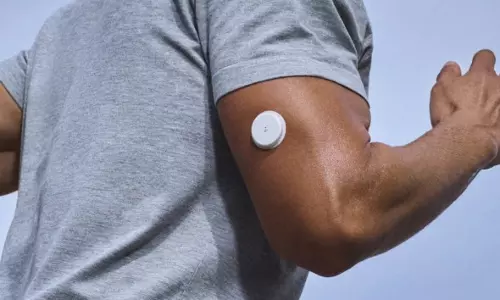 Continuous Glucose Monitors Are in Vogue. But Do You Really Need to Track Your Blood Sugar?