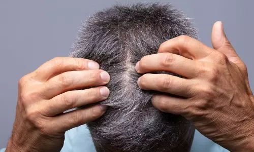 The Root of It All: Why an Oily Sticky Scalp Could Be the Reason Your Hair Feels Lifeless