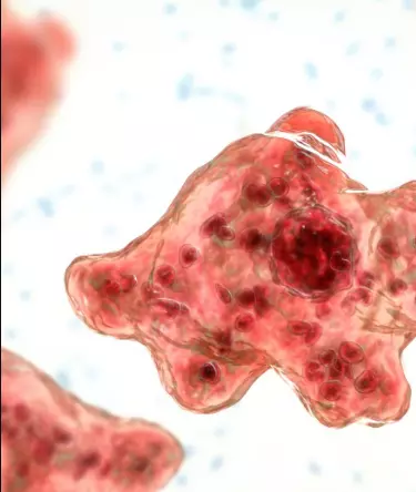 Fresh Amoebic Encephalitis Case Reported in Kerala