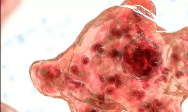 Fresh Amoebic Encephalitis Case Reported in Kerala