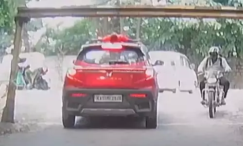 8-Year-Old Boys Forehead Bangs To Iron Beam, Escapes Unhurt in Bengaluru 8-Year-Old Boys Forehead Bangs To Iron Beam, Escapes Unhurt in Bengaluru