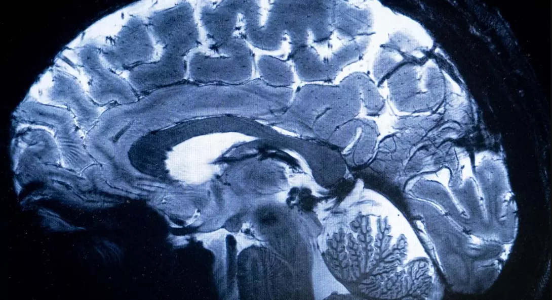 Kerala Reports Fifth Death From Rare Amoebic Brain Infection