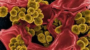 Deadly ‘Melioidosis’, Generated From Rice Fields, Spreading Across MP, Experts Warn