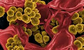 Deadly ‘Melioidosis’, Generated From Rice Fields, Spreading Across MP, Experts Warn