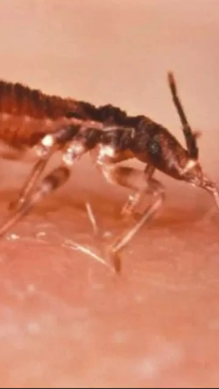 Chagas Disease: Causes, Symptoms and Treatment Explained