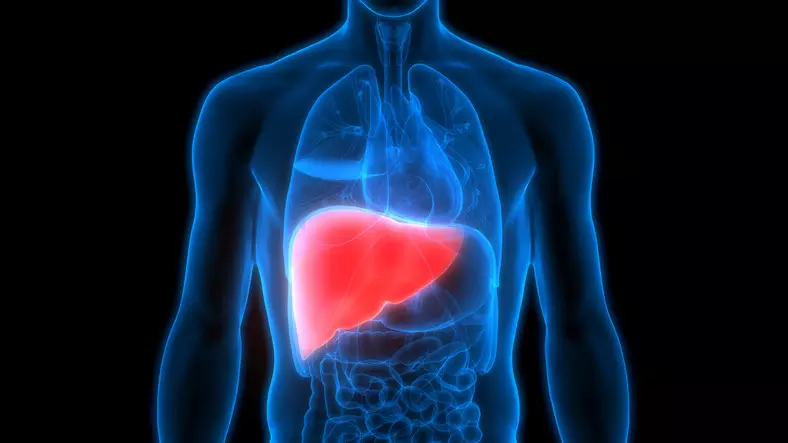 How to Reverse Grade 3 Fatty Liver, A Case Study