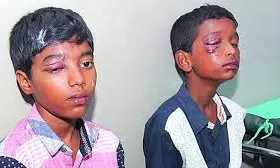 Bystanders Among The Injured As Sarojini Devi Eye Hospital Records 62 Diwali Cases