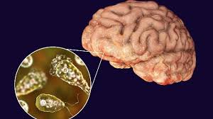 Kerala Launches Joint Field Study on Rare Brain Infection After 30 Deaths