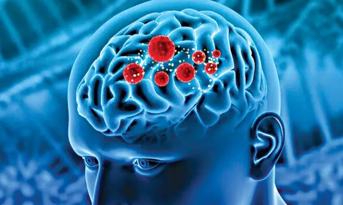 Stars Shine Light on Brain Matters